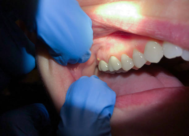 Best Broken or Chipped Tooth Repair in Dresser, WI