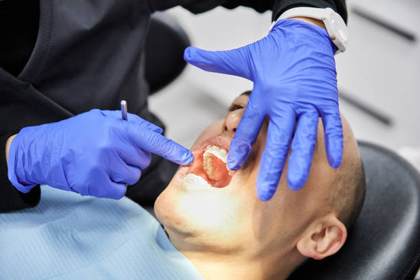 Best Emergency Wisdom Tooth Extraction in Dresser, WI